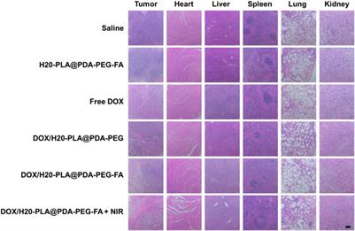 Polydopamine surface-modified hyperbranched polymeric nanoparticles for synergistic chemo/photothermal therapy of oral cancer